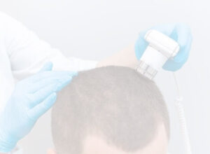 What Questions Should You Ask Before Choosing a Hair Loss Treatment?