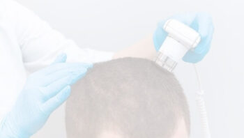 What Questions Should You Ask Before Choosing a Hair Loss Treatment?