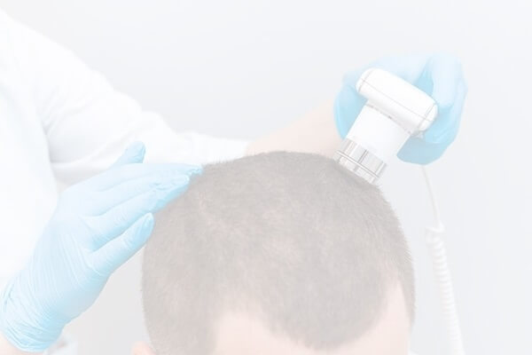 Choosing a Hair Loss Treatment