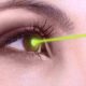 FAQs About Laser Eye Surgery